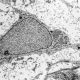 Confirmado el potencial de las células madre mesenquimales para tratar el lupus
